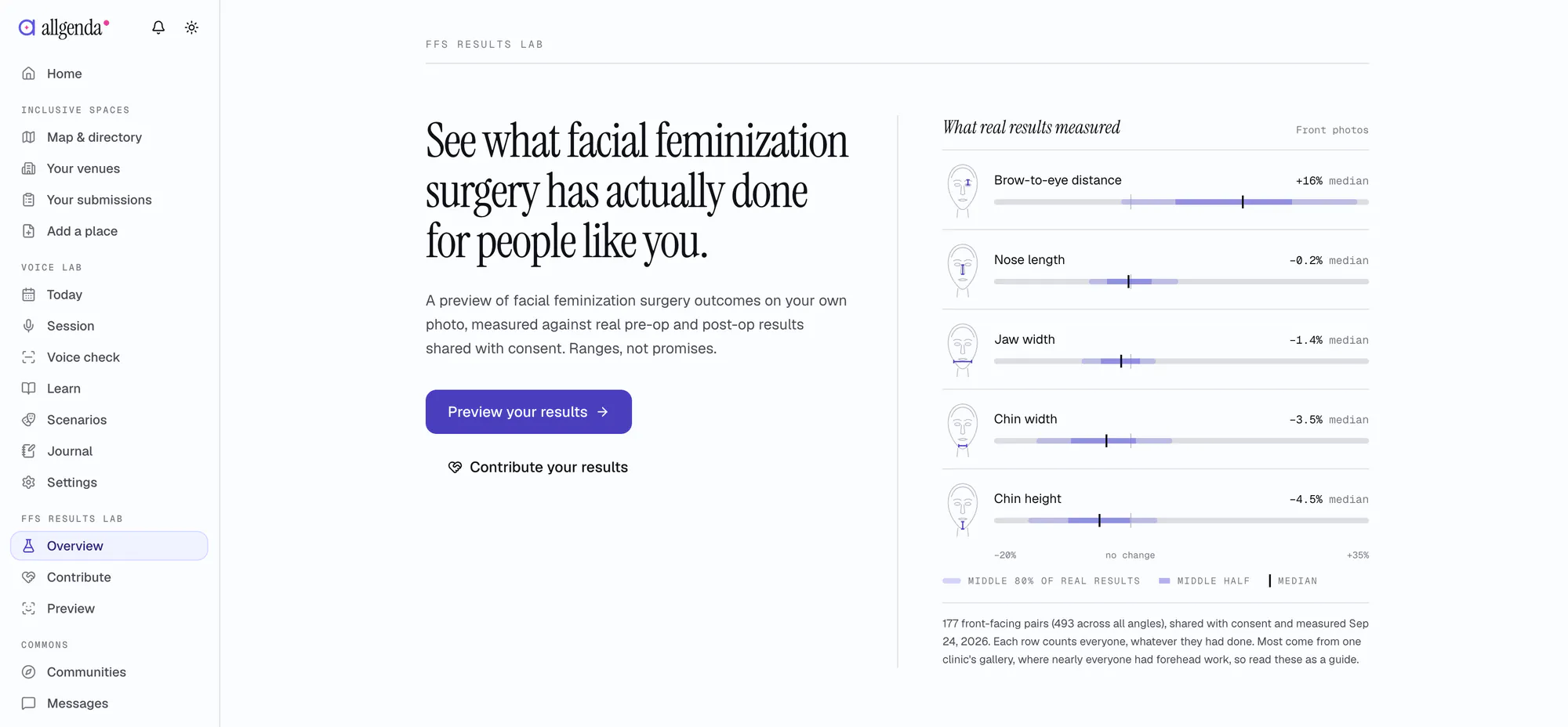 The FFS Results Lab overview: a serif headline about what facial feminization surgery has actually done for people, and a chart of five facial measurements, each with bars for the middle 80%, the middle half and the median change in real results